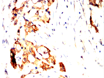 PFKM Antibody