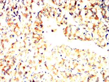 PFKM Antibody