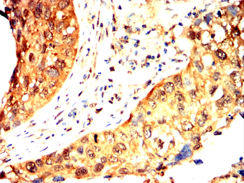 MDM2 Antibody