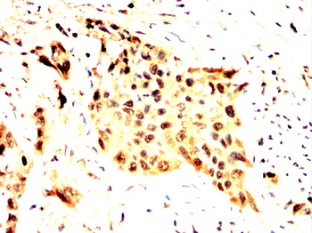 MDM2 Antibody