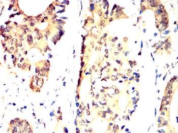 MDM2 Antibody