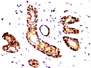 CHRNB1 Antibody