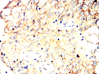 CHRNB1 Antibody