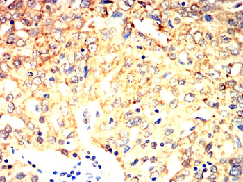 CHRNB1 Antibody