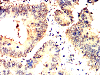 CHRNB1 Antibody
