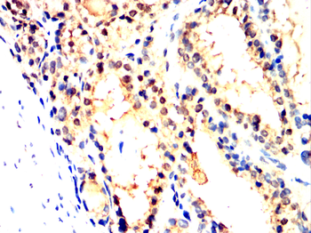 CHRNB1 Antibody