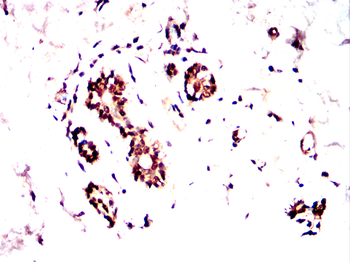 PTPN11 Antibody
