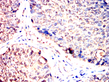 PTPN11 Antibody