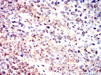 PTPN11 Antibody