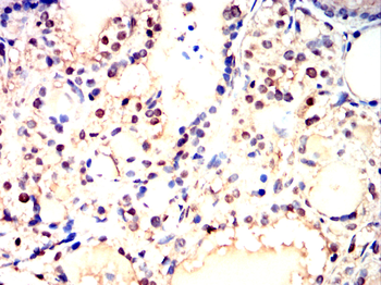 PTPN11 Antibody