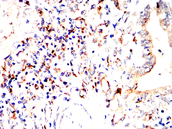 CD163 Antibody