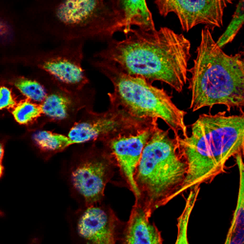 ALB Antibody