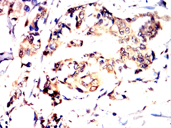 ALB Antibody