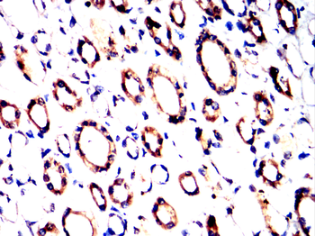 ALB Antibody