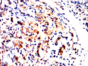 ALB Antibody