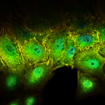 FOS Antibody