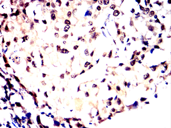 FOS Antibody