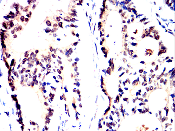 FOS Antibody