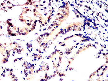 FOS Antibody
