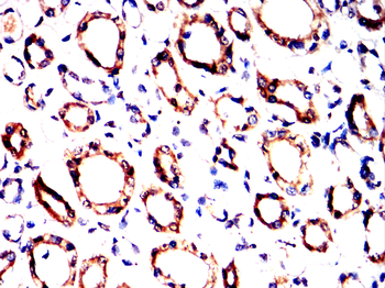 FOS Antibody
