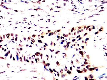 FOS Antibody