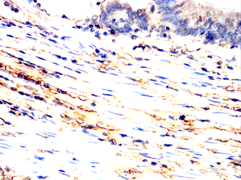 CD38 Antibody
