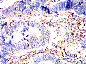 CD38 Antibody