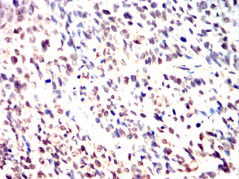RAD51 Antibody