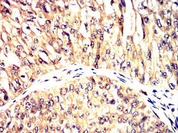 BRAF Antibody