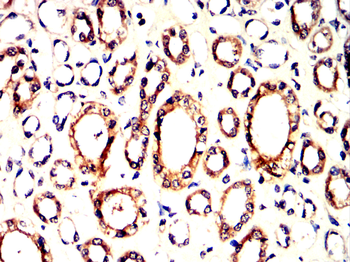 BRAF Antibody