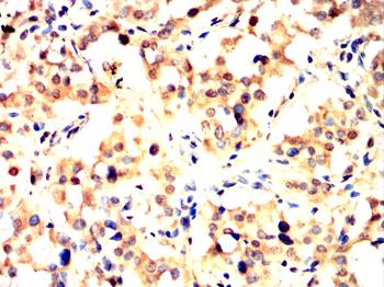 BRAF Antibody