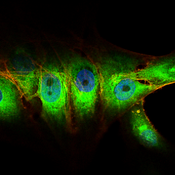 PMP22 Antibody