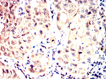 TP53BP1 Antibody