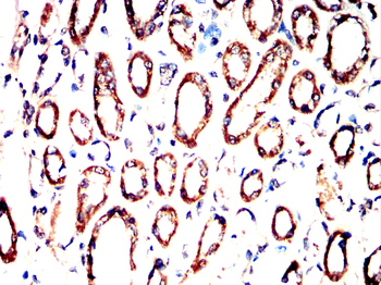 ATG5 Antibody
