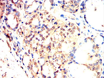 ATG5 Antibody