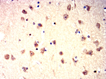 AURKA Antibody