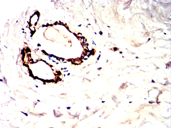 AURKA Antibody