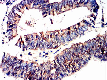 AURKA Antibody