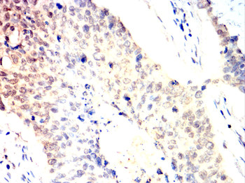AURKA Antibody
