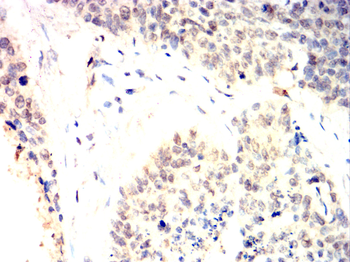 AURKA Antibody