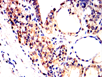 AURKA Antibody