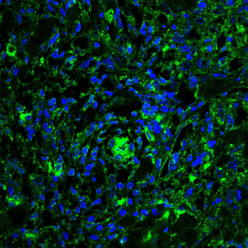 ATM Antibody