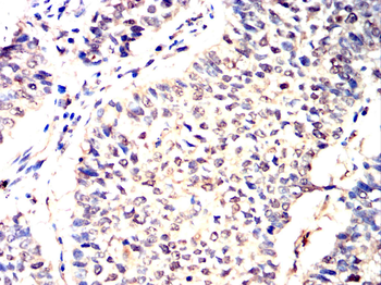 ATM Antibody