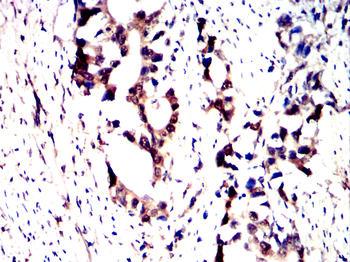 ATM Antibody