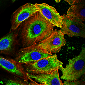 ROCK1 Antibody