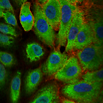 CHUK Antibody