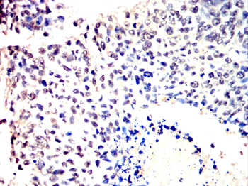 CHUK Antibody
