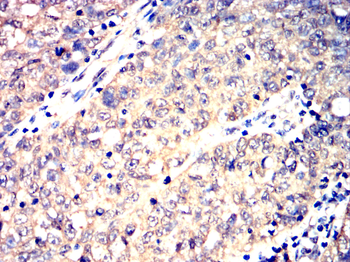 CHUK Antibody