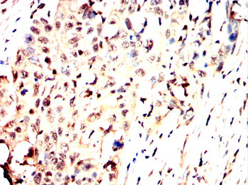 NFKBIA Antibody