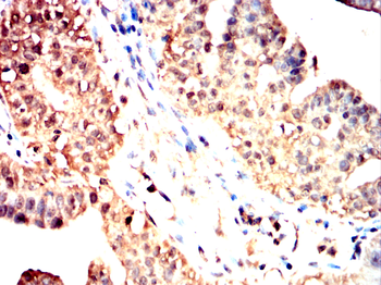 NFKBIA Antibody